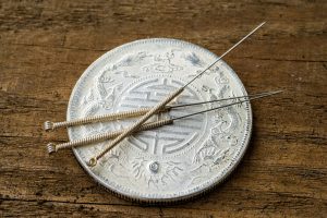 acupuncture needles with chinese coin
